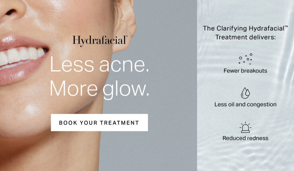 Hydrafacial less acne, more glow, hydrafacial treatment